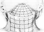 Schéma d'un remaillage du visage